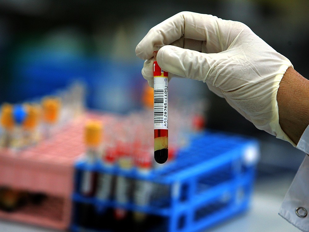Was Ist Eine Antikörpertherapie? Wird es gegen das Corona Virus angewendet?