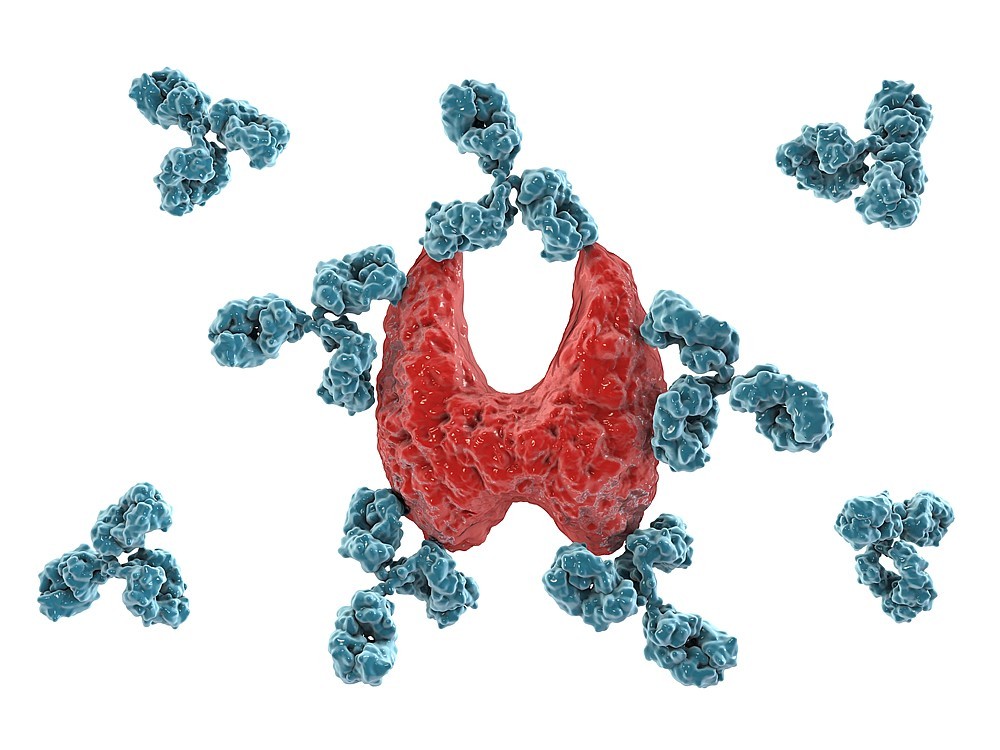 Was Ist Autoimmunthyreoiditis? Lebensmittel, die für Symptome, Schäden und Autoimmunthyreoiditis gut sind