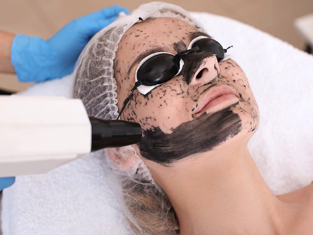 Was Ist Carbon Peeling? Was sind die Nachteile und Vorteile? Diejenigen, die den Preis und bevorzugen