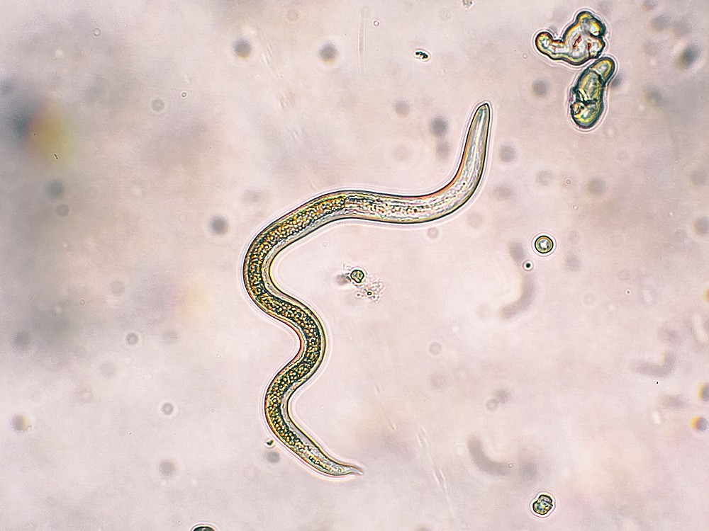 Der natürliche Weg, Parasiten loszuwerden und Kräuterlösung