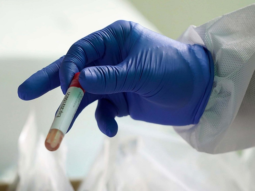 Was Ist Immunplasma? Wie Wird Corona Zur Behandlung Des Virus Angewendet?