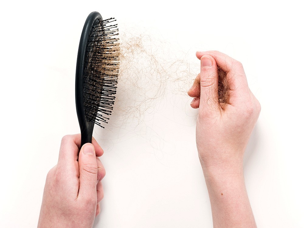 Ist Haarausfall genetisch? Wie Erkennt Man?