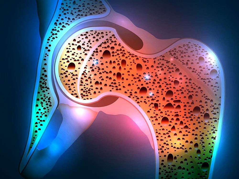Was Ist Knochenresorption? Was sind die Symptome und Ursachen? Was Hilft?
