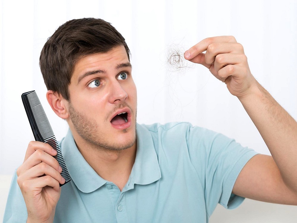 Natürliche Lösungen, Um Haarausfall Bei Männern Zu Verhindern