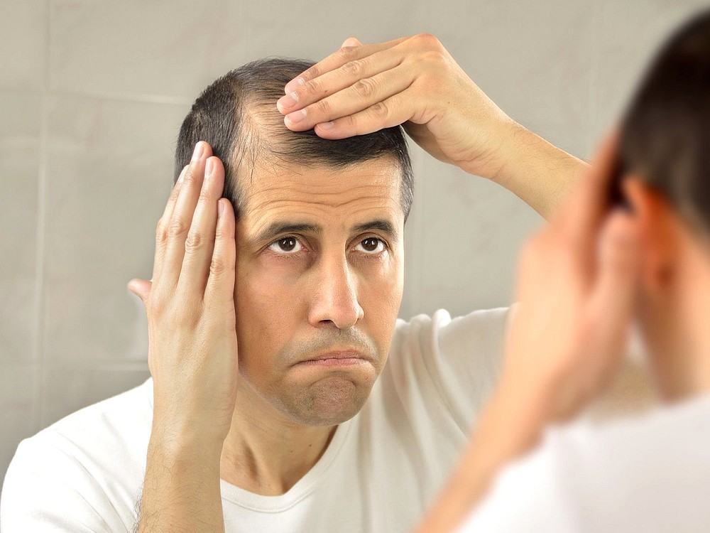 Pflanzliche und natürliche Lösung gegen Haarausfall