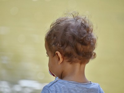 Was Verursacht Haarausfall Bei Kindern? Wie heilt er?