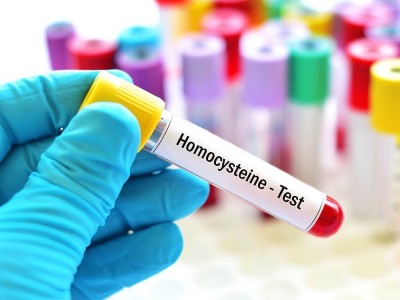 Was Ist Homocystein? Was Sind Die Gründe Für Den Anstieg Von Homocystein? Symptome und Behandlung