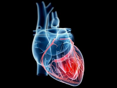 Was Ist Koronare Herzkrankheit? Chronisch?