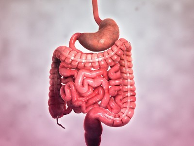 Was Ist Morbus Crohn? Was sind die Ursachen und Symptome?