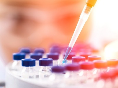 Was ist die PCR Methode? Wie wird ein PCR Test auf Corona Virus durchgeführt?
