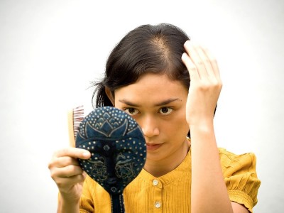 Ursachen von Haarverlust bei Frauen und Kahlheit